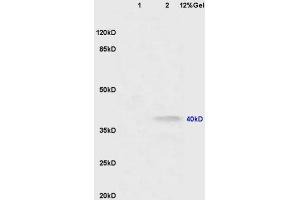 Lane 1: mouse lung lysates Lane 2: mouse brain lysates probed with Anti CNR2/CB2 Polyclonal Antibody, Unconjugated (ABIN680168) at 1:200 in 4 °C. (CNR2 anticorps  (AA 251-350))