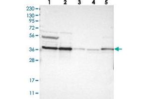 Western blot analysis of Lane 1: RT-4, Lane 2: U-251 MG, Lane 3: Human Plasma, Lane 4: Liver, Lane 5: Tonsil with CALHM2 polyclonal antibody . (CALHM2 anticorps)