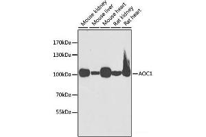 Western blot analysis of extracts of various cell lines using AOC1 Polyclonal Antibody at dilution of 1:1000. (DAO anticorps)