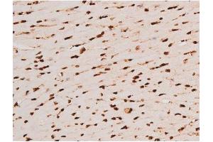 ABIN6267604 at 1/200 staining Mouse heart tissue sections by IHC-P.