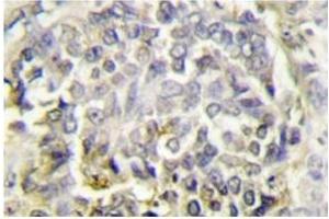 Image no. 1 for anti-PYD and CARD Domain Containing (PYCARD) antibody (ABIN272291) (PYCARD anticorps)