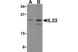 Western blot analysis of IL-23 in mouse pancreas tissue lysate with AP30419PU-N IL-23 antibody at (A) 1 and (B) 2 μg/ml. (IL23A anticorps  (N-Term))
