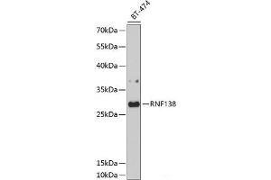 Western blot analysis of extracts of BT-474 cells using RNF138 Polyclonal Antibody at dilution of 1:1000. (RNF138 anticorps)