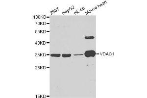 Western blot analysis of extracts of various cell lines, using VDAC1 antibody. (VDAC1 anticorps  (AA 1-283))