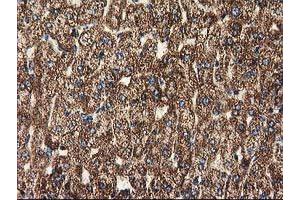 Image no. 1 for anti-ClpP Caseinolytic Peptidase, ATP-Dependent, Proteolytic Subunit Homolog (E. Coli) (CLPP) antibody (ABIN1497535)