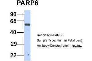 Host:  Rabbit  Target Name:  P Sample Type:  Human Fetal Lung  Antibody Dilution:  1. (PARP6 anticorps  (N-Term))
