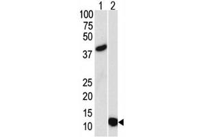 Western blot analysis of SUMO3 antibody and (1) GST-SUMO3 recombinant protein and (2) HL-60 lysate. (SUMO3 anticorps)