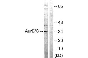 Western Blotting (WB) image for anti-Aurora Kinase B/C (AURKB/C) (Thr175), (Thr202) antibody (ABIN1848068)
