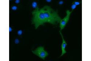 Anti-KLHL2 mouse monoclonal antibody (ABIN2453208) immunofluorescent staining of COS7 cells transiently transfected by pCMV6-ENTRY KLHL2 (RC205347). (KLHL2 anticorps  (AA 1-100, AA 494-593))