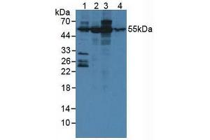 Figure. (Ataxin 10 anticorps  (AA 116-302))