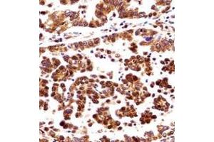 anti-Origin Recognition Complex, Subunit 3 (ORC3) (AA 16-46), (N-Term) antibody