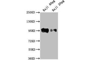 Western Blot Positive WB detected in: Raji whole cell lysate All lanes: CD19 antibody at 1:2000 Secondary Goat polyclonal to Mouse IgG at 1/10000 dilution Predicted band size: 61 kDa Observed band size: 95 kDa