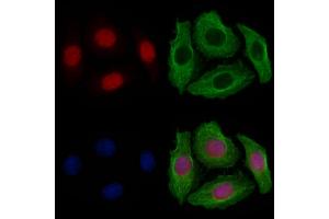 ABIN6262123 and ABIN6277531 staining Hela cells by IF/ICC.