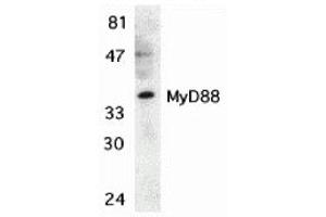 Western Blotting (WB) image for anti-Myeloid Differentiation Primary Response Gene (88) (MYD88) (C-Term) antibody (ABIN1030526) (MYD88 anticorps  (C-Term))