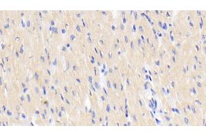 Detection of ACVR1 in Human Cardiac Muscle Tissue using Polyclonal Antibody to Activin A Receptor Type I (ACVR1)
