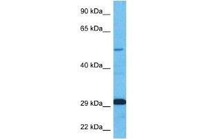 Host:  Rabbit  Target Name:  ZNF35  Sample Type:  Fetal Kidney lysates  Antibody Dilution:  1. (ZNF35 anticorps  (N-Term))