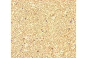 Immunohistochemistry of paraffin-embedded human brain tissue using ABIN7168865 at dilution of 1:100 (Septin 2 anticorps  (AA 1-361))