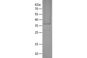 Western Blotting (WB) image for TIA1 Cytotoxic Granule-Associated RNA Binding Protein (TIA1) (AA 2-285) protein (His tag) (ABIN7125397)