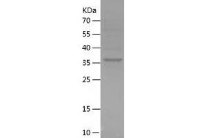 Western Blotting (WB) image for Coiled-Coil Domain Containing 25 (CCDC25) (AA 1-140) protein (His-IF2DI Tag) (ABIN7122428)