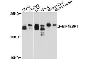 Western blot analysis of extracts of various cell lines, using EIF4EBP1 antibody (ABIN5970590) at 1/1000 dilution. (eIF4EBP1 anticorps)