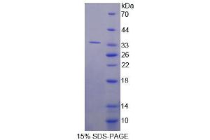 SDS-PAGE (SDS) image for Ras Suppressor Protein 1 (RSU1) (AA 2-277) protein (His tag) (ABIN4989524) (RSU1 Protein (AA 2-277) (His tag))