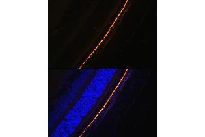 anti-Retinal Pigment Epithelium-Specific Protein 65kDa (RPE65) (AA 274-533) antibody