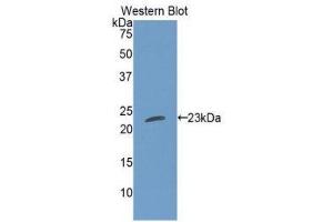 Western Blotting (WB) image for anti-Cardiotrophin 1 (CTF1) (AA 1-201) antibody (ABIN3207807) (Cardiotrophin 1 anticorps  (AA 1-201))
