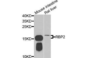 Western blot analysis of extracts of mouse intestine and rat liver cells, using RBP2 antibody. (RBP2 anticorps)