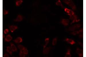 ABIN6274798 staining HT29 by IF/ICC. (ACSS1 anticorps  (C-Term))