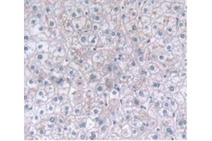 Detection of CLEC4C in Human Liver Tissue using Polyclonal Antibody to C-Type Lectin Domain Family 4, Member C (CLEC4C) (CLEC4C anticorps  (AA 5-152))