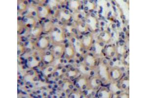 Used in DAB staining on fromalin fixed paraffin-embedded Kidney tissue