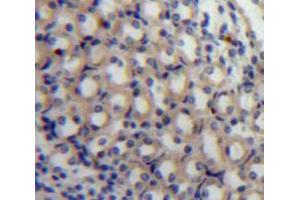 Used in DAB staining on fromalin fixed paraffin-embedded Kidney tissue (MAP4 anticorps  (AA 882-1062))