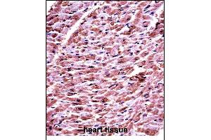 DHRS7C Antibody (Center) ((ABIN657710 and ABIN2846701))immunohistochemistry analysis in formalin fixed and paraffin embedded human heart tissue followed by peroxidase conjugation of the secondary antibody and DAB staining. (DHRS7C anticorps  (AA 116-145))