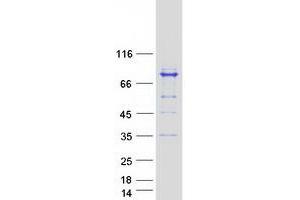 Validation with Western Blot