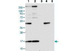 Western blot analysis of Lane 1: RT-4, Lane 2: U-251 MG, Lane 3: Human Plasma, Lane 4: Liver, Lane 5: Tonsil with RPS19BP1 polyclonal antibody  at 1:250-1:500 dilution. (RPS19BP1 anticorps)