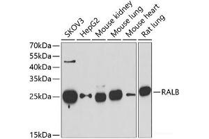 Western blot analysis of extracts of various cell lines using RALB Polyclonal Antibody at dilution of 1:1000. (RALB anticorps)