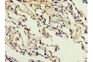 Immunohistochemistry of paraffin-embedded human lung tissue using ABIN7150057 at dilution of 1:100