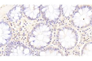 Detection of SGPL1 in Human Colon Tissue using Polyclonal Antibody to Sphingosine 1 Phosphate Lyase 1 (SGPL1)