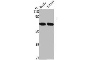 Western Blot analysis of HuvEc Jurkat cells using STK33 Polyclonal Antibody (STK33 anticorps  (N-Term))