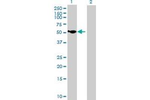 Western Blot analysis of HGD expression in transfected 293T cell line by HGD MaxPab polyclonal antibody. (HGD anticorps  (AA 1-445))