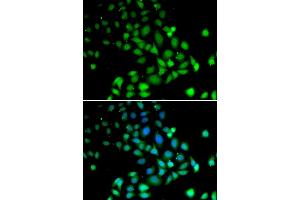 Immunofluorescence analysis of U2OS cells using PARN antibody. (PARN anticorps)