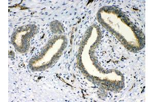 IHC analysis of PPID using anti-PPID antibody .