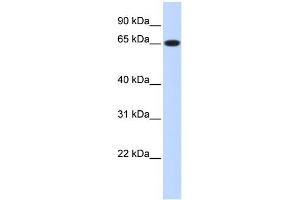 WB Suggested Anti-RPN1 Antibody Titration:  0. (RPN1 anticorps  (Middle Region))