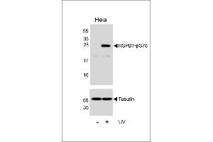 Western blot analysis of lysates from Hela cell line, untreated or treated with UV, 2 hours, using HSPB1 Antibody (R)(upper) or Tubulin (lower). (HSP27 anticorps  (pSer78))