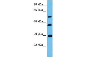 Host:  Mouse  Target Name:  PBX2  Sample Tissue:  Mouse Pancreas  Antibody Dilution:  1ug/ml (PBX2 anticorps  (N-Term))