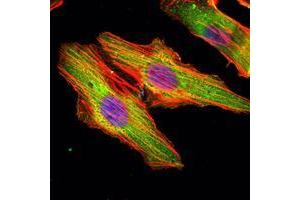 anti-Matrilin 1, Cartilage Matrix Protein (MATN1) antibody