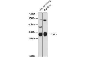 Western blot analysis of extracts of various cell lines, using TH antibody (ABIN6132722, ABIN6149110, ABIN6149112 and ABIN6216701) at 1:3000 dilution.