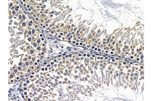 ABIN6257467 and ABIN6274784 at 1/100 staining rat testis tissue by IHC-P. (RPL7 anticorps  (C-Term))