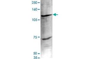 Nuclear extracts of HeLa cells (40 ug) were analysed by Western blot using Ehmt1 polyclonal antibody  diluted 1 : 1,000 in TBS-Tween containing 5% skimmed milk.