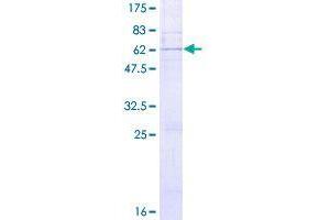 Image no. 1 for alpha-N-Acetylgalactosaminide alpha-2,6-Sialyltransferase 3 (SIA7C) (AA 1-305) protein (GST tag) (ABIN1321509)